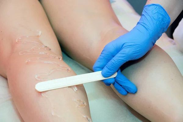 Laser Hair Removal Procedure Beauty Salon Removal Unwanted Leg Hair — Stock Photo, Image