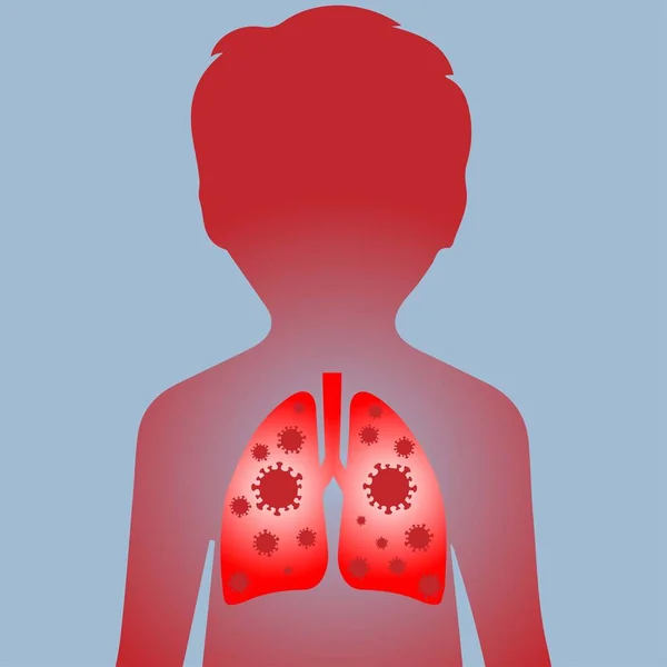 Ciğerleri Enfekte Olmuş Bir Çocuğun Silüeti — Stok Vektör