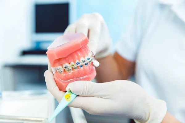 Dentist holding orthodontics braces in hand — Stock Photo, Image