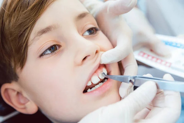 口腔検査中の少年の閉鎖 — ストック写真