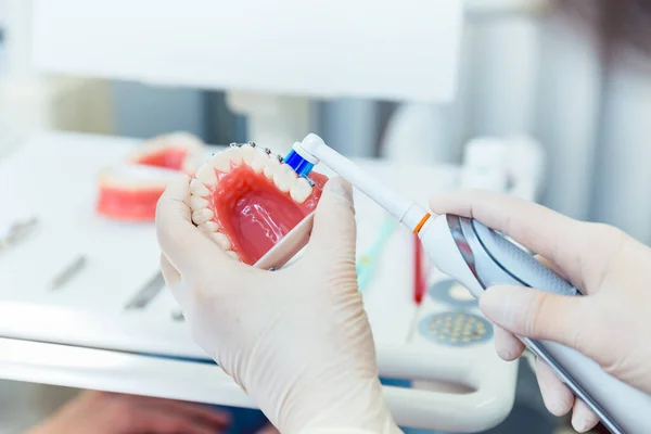 Dentist brushing the denture with electric toothbrush — Stock Photo, Image