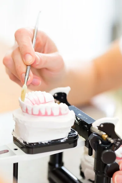 Dental technician producing denture — Stock Photo, Image