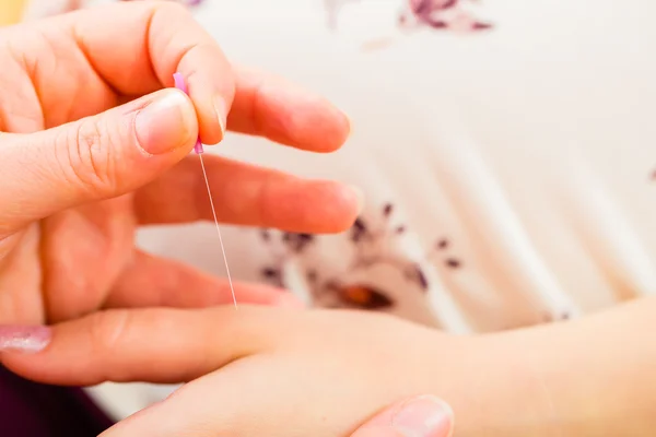 Ostetrica dando gravidanza agopuntura — Foto Stock