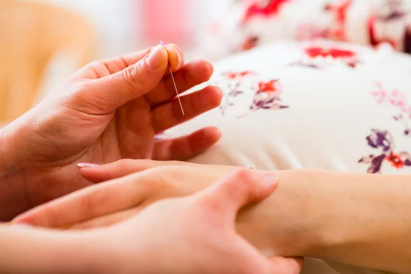 Położna dając ciąży akupunktury — Zdjęcie stockowe