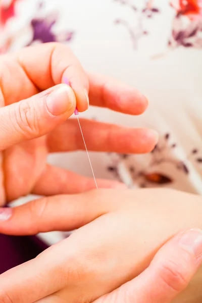 Ostetrica dando gravidanza agopuntura — Foto Stock