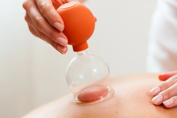 Patiënt op de kinesitherapie - cupping — Stockfoto