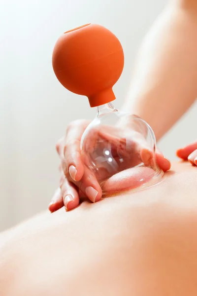 Patiënt op de kinesitherapie - cupping — Stockfoto