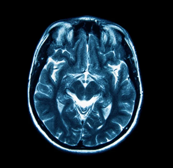 Escaneamento de Mri — Fotografia de Stock