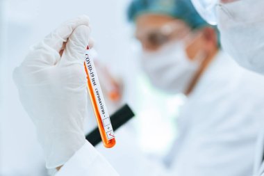 Laboratuvar asistanının ellerinde Coronavirus testi olan etiketli bir tüpün arkaplan resmi.