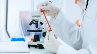Bir laboratuvar çalışanının elinde test tüpü. .