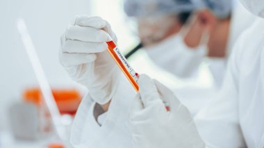 Laboratuvar asistanının ellerinde Coronavirus testi olan etiketli bir tüpün arkaplan resmi.