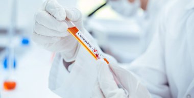 Kapat. Sıhhiyenin elinde koronavirüs testi yapılan bir tüp..