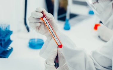 Kapat. Sıhhiyenin elinde test olan tüp..
