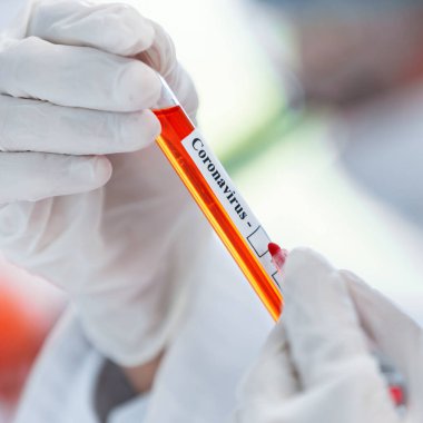 arkaplan resmi test testi ile tüpü işaretliyor.