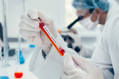 Kapat. Laboratuvar teknisyeni tüpün üzerinde bir iz bırakıyor..