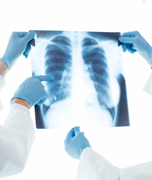 Nahaufnahme. Ärzte in Schutzmasken betrachten ein Röntgenbild der Lungen . — Stockfoto