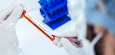 Kapat. Bilim adamı, tüpün üzerine bir işaret koydu..