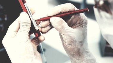 Kapat. Bilim adamı bir tüpü testle işaretliyor..