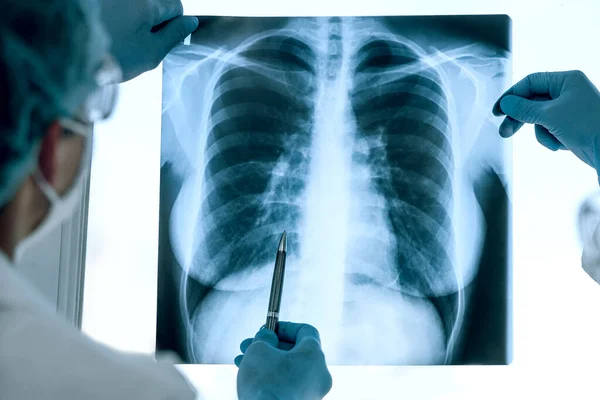 De cerca. doctores con ropa protectora discutiendo una radiografía de los pulmones . — Foto de Stock