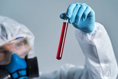 Test sonuçları bir virüs bilimcisinin ellerinde..