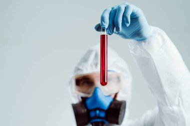 Test sonuçları bir virüs bilimcisinin ellerinde..