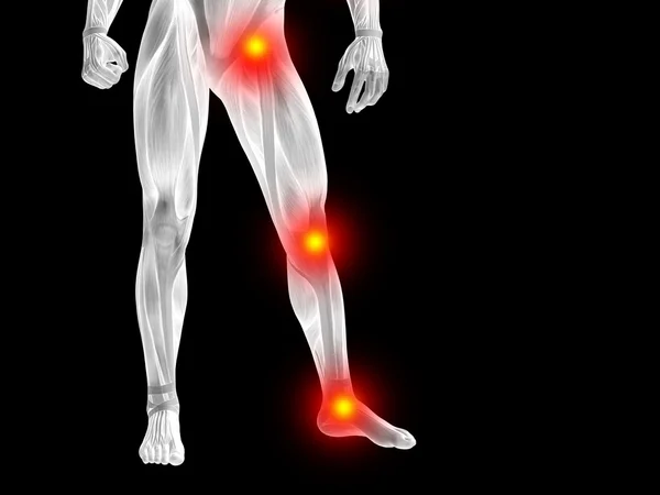 Joints or articular pain, ache — Stock Photo, Image