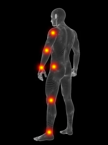 Wireframe lichaam met pijn — Stockfoto