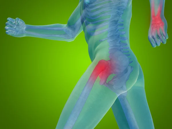 Joint,  articular pain, ache — Stock Photo, Image