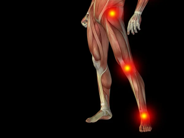 Joints or articular pain, ache — Stock Photo, Image