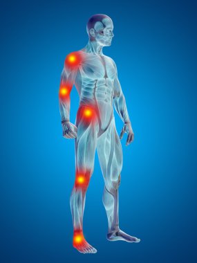 Adam ile ile eklem veya kemik ağrısı.