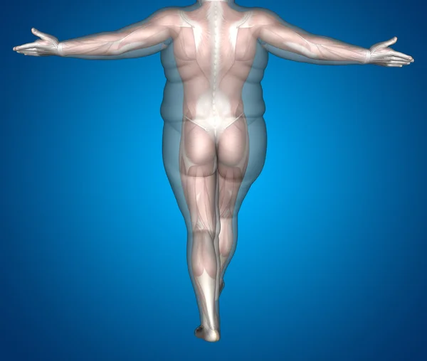 Λίπος υπέρβαροι vs αδύνατου άνδρα — Φωτογραφία Αρχείου
