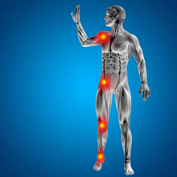 Man with  with articular or bones pain. — Stock Photo, Image