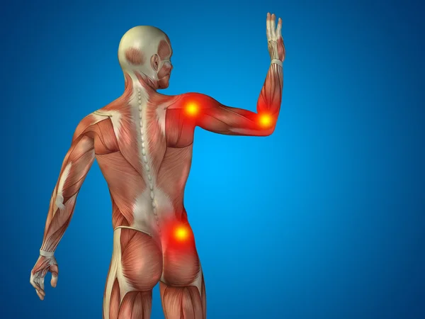 青の背景に怪我の痛みや関節や関節の痛み概念 3 d 人間解剖学上身体や健康デザイン — ストック写真