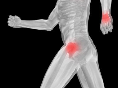 kavramsal adam anatomisi