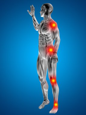 eklem ağrısı olan insan. 