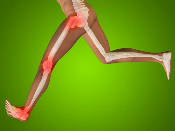 Joints or articular pain, ache — Stock Photo, Image