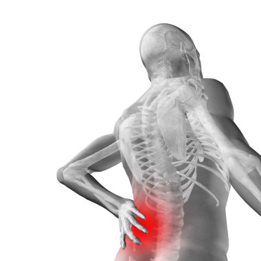  adam anatomisi arka ağrı ile 