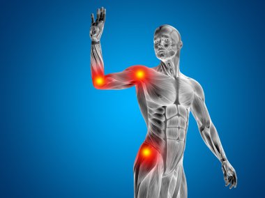 eklem veya eklem ağrısı, ağrı