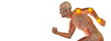 eklem veya eklem ağrısı, ağrı 