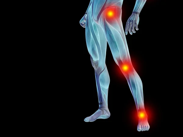 Lower body, joints  pain — Stock Photo, Image