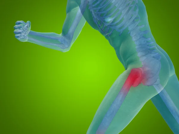 Joint or articular pain, ache — Stock Photo, Image