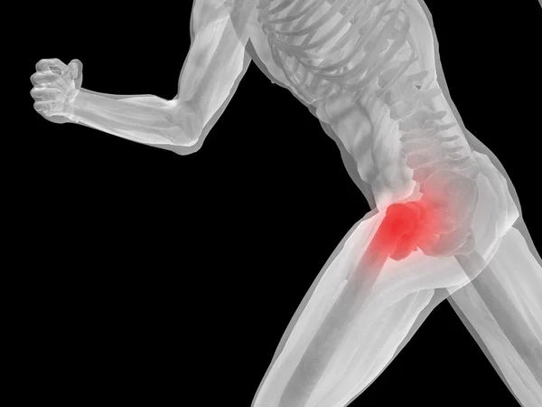 Joints or articular pain, ache — Stock Photo, Image