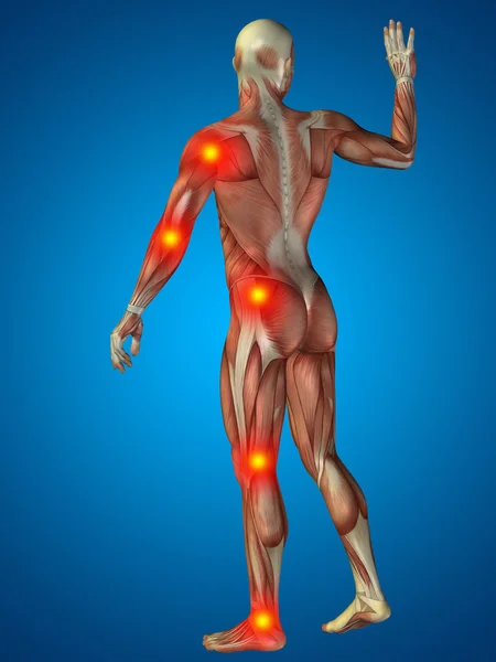Man  with articular or bones pain — Stock Photo, Image
