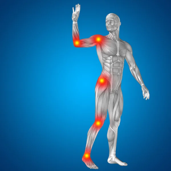 Homem com dor articular ou óssea — Fotografia de Stock