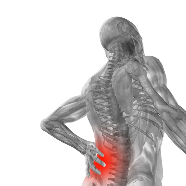 Man anatomy with back pain — Stock Photo, Image