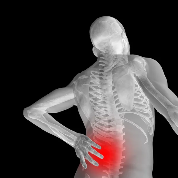 Man anatomy with back pain — Stock Photo, Image
