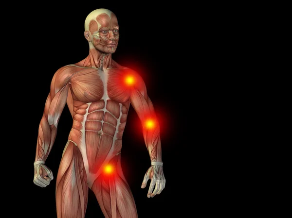 人体解剖学、 关节或关节疼痛 — 图库照片