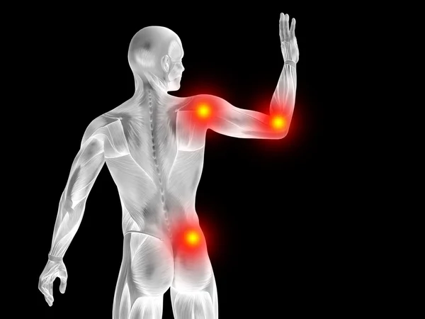Menselijke anatomie, gewrichten of articulaire pijn — Stockfoto