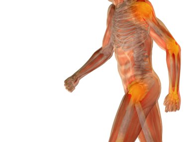 eklem veya eklem ağrısı, ağrı