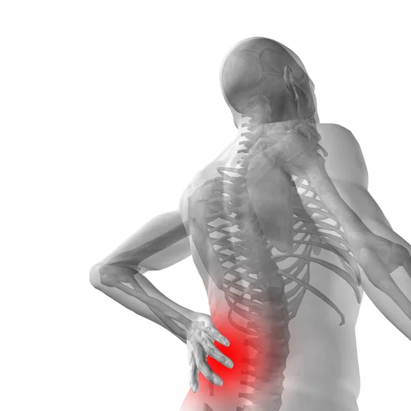 Анатомия человека с болью в спине — стоковое фото